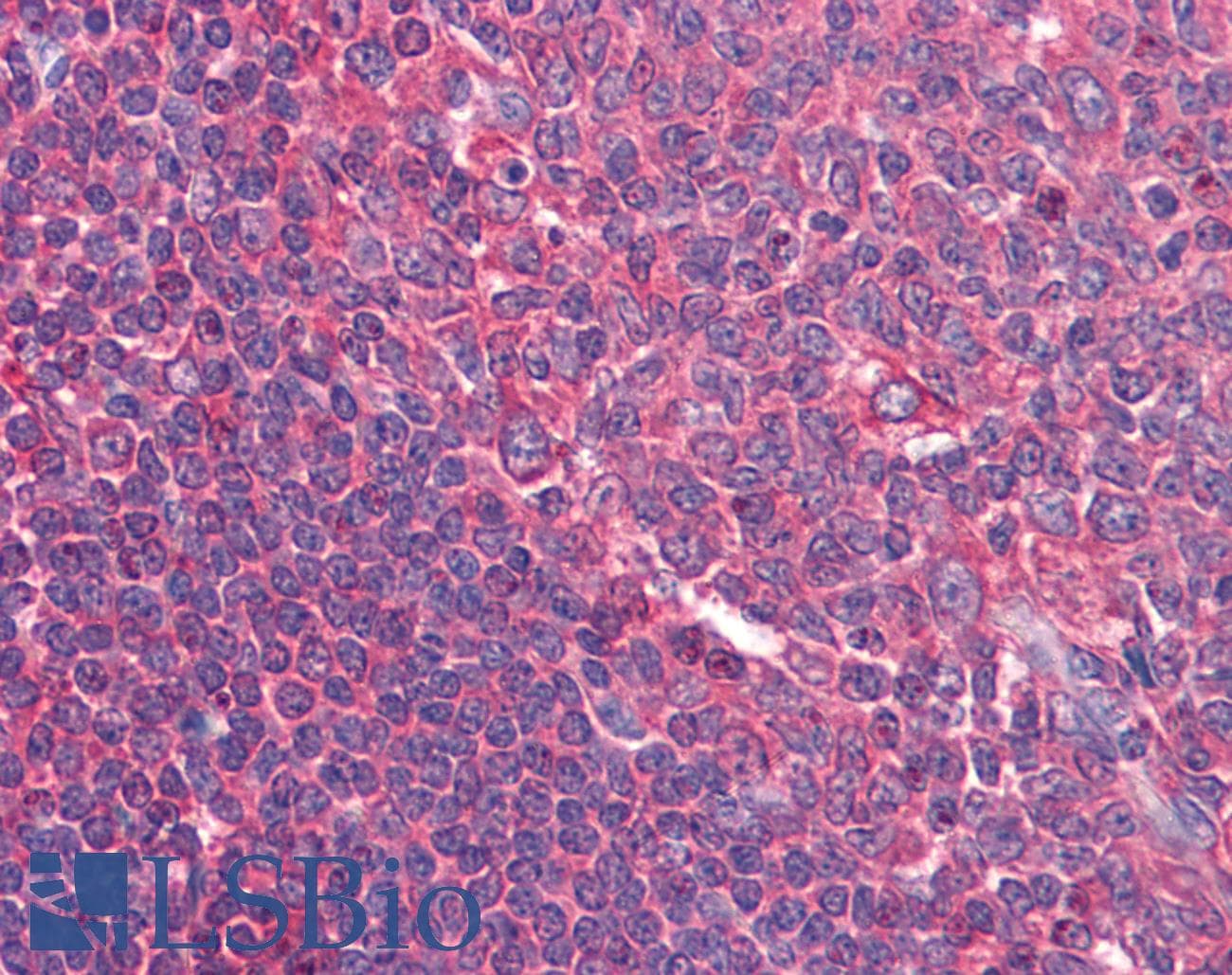 IHC-plus™ Monoclonal Mouse anti-Human CD80 Antibody (clone 2A2, IHC, IF)