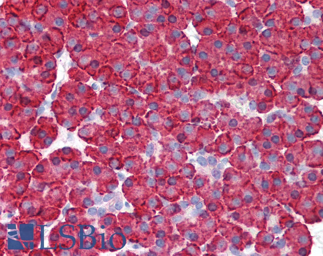 IHC-plus™ IFIH1 / MDA5 Antibody
