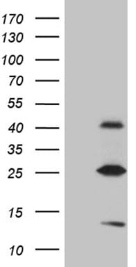 METTL7A Antibody (aa34-104, clone OTI4B10)