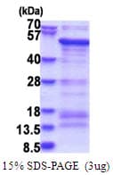 Human SAMSN1 Protein (Recombinant His)