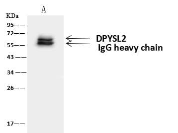 Polyclonal Rabbit anti-Human DPYSL2 / CRMP2 Antibody (IF, WB)