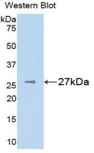 Polyclonal Rabbit anti-Human CSPG4 / NG2 Antibody (aa1705-1942, WB)