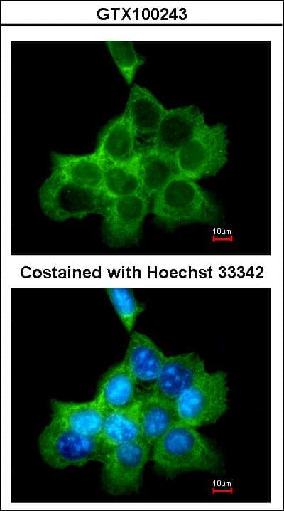 DOCK180 / DOCK1 Antibody (aa1802-1865)