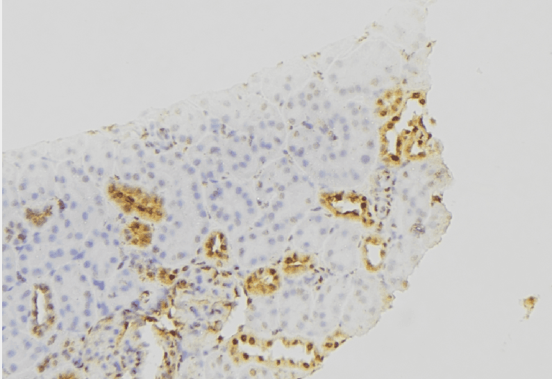 PIGC Antibody