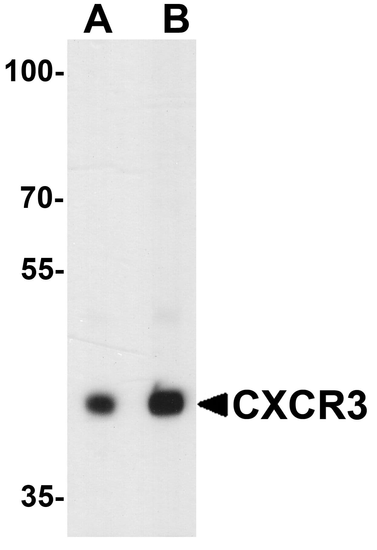 IHC-plus™ Polyclonal Rabbit anti-Human CXCR3 Antibody (IHC, IF, WB)