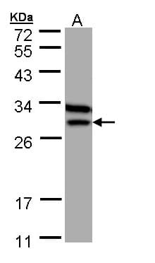 ETFB Antibody (aa1-255)