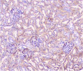TNFRSF1A / TNFR1 Antibody