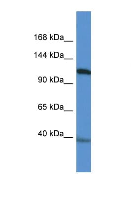 MYOCD / Myocardin Antibody (aa237-286)