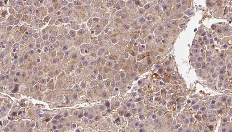 Polyclonal Rabbit anti-Human DIRAS3 / ARHI Antibody (IHC, WB)