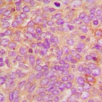 DFFA / ICAD / DFF45 Antibody (Internal)