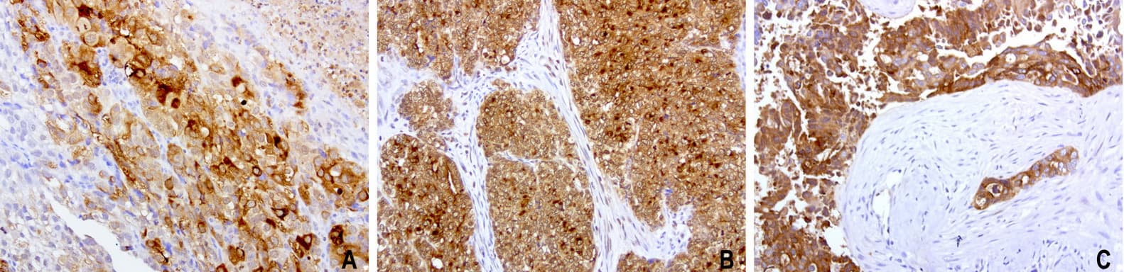 WFDC2 / HE4 Antibody (aa31-124, clone UMAB87)