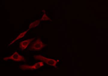 HSD11B1 / HSD11B Antibody