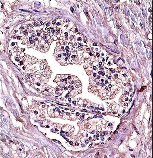 PPP4C Antibody (aa160-189)