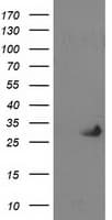 Monoclonal Mouse anti-Human PNMT Antibody (clone OTI1D5, IF, WB)
