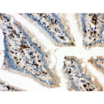 CFL1 / Cofilin Antibody (aa122-152)