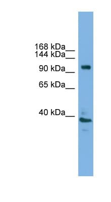 ATP6V0A1 Antibody (aa671-720)
