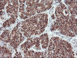 ECI2 / PECI Antibody (clone OTI1C8)