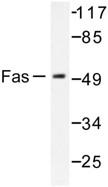CD95 / FAS Antibody (Leu315)