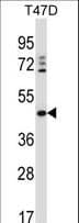 Polyclonal Rabbit anti-Human DEGS1 Antibody (aa1-30, IHC, WB)