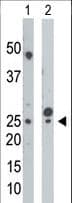 CMPK / CMPK1 Antibody (aa18-48)