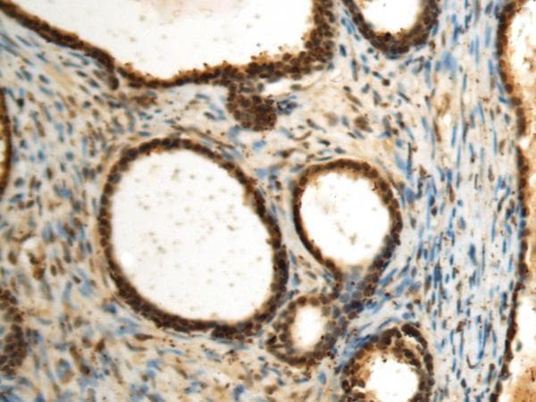 Polyclonal Rabbit anti-Human SEPHS1 / SPS Antibody (IHC)