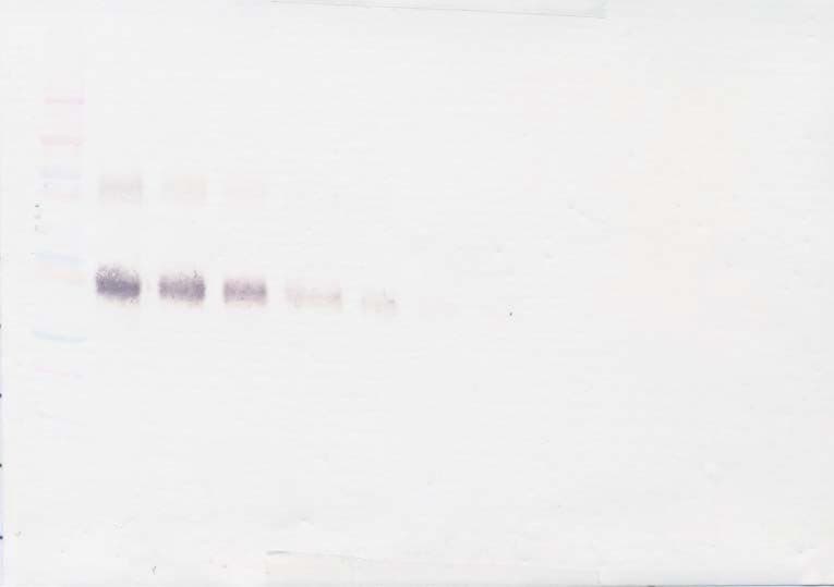 IL2RA / CD25 Antibody