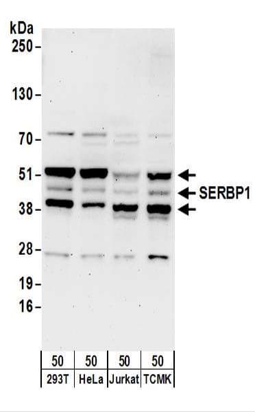 IHC-plus™ PAI-RBP1 / SERBP1 Antibody (aa100-150)