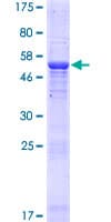 Human THAP5 Protein (Recombinant GST)