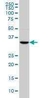 HOXC4 Antibody (clone 1E9)