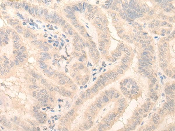 HMBS / PBGD Antibody