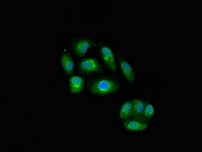 Polyclonal Rabbit anti-Human IL23A / IL-23 p19 Antibody (IHC, IF)