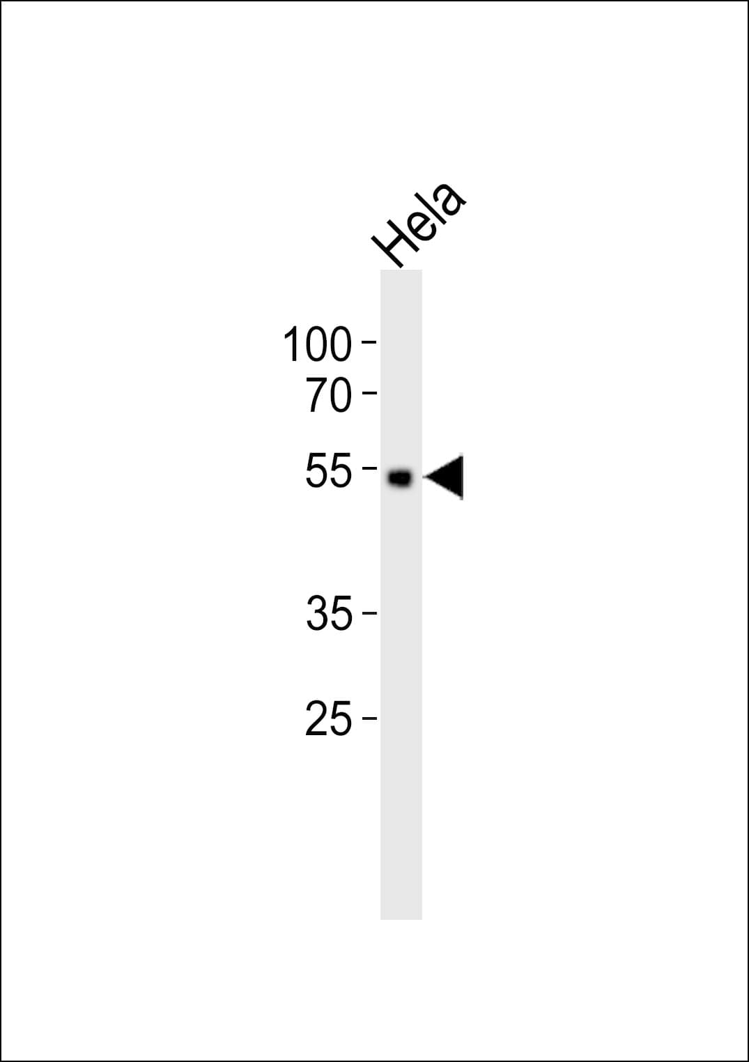 UMPS / OPRT Antibody (Tyr37)