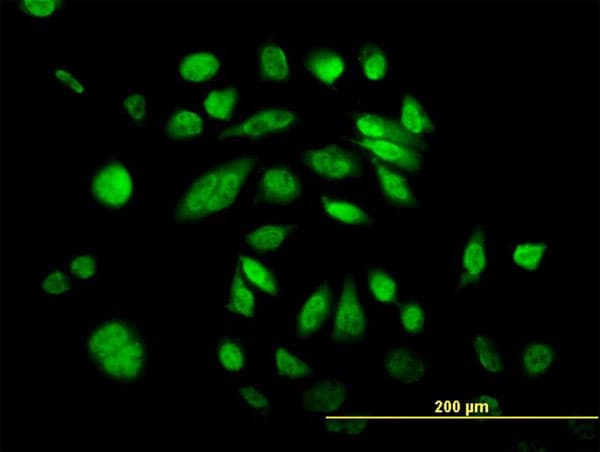 IHC-plus™ Monoclonal Mouse anti-Human POLK / DNA Polymerase Kappa Antibody (clone 6F2, IHC, IF, WB)