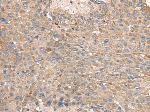 ABCA10 Antibody