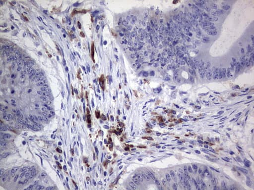 PDGFRA / PDGFR Alpha Antibody (aa32-324, clone 2E9)