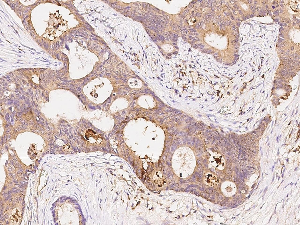 PRKACA Antibody (Preservative Free)