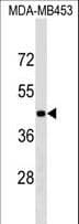 Polyclonal Rabbit anti-Human GRSF1 Antibody (aa307-333, WB)