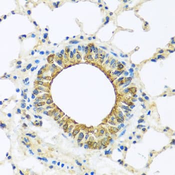 DCP2 Antibody