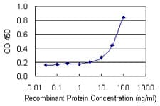NR2F1 / Coup-TF Antibody (clone 1A4)