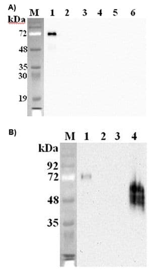 DLK1 / Pref-1 Antibody (Extracellular Domain, clone PF105B)