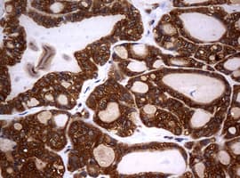 NME1 / NM23 Antibody (clone OTI1A12)