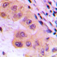 Polyclonal Rabbit anti-Human CTPS Antibody (N-Terminus, IHC, WB)
