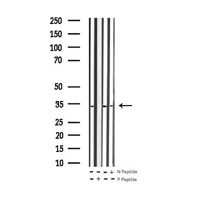 BCL2L1 / BCL-XL Antibody (phospho-Ser62)