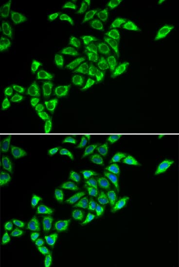 DLAT / PDC-E2 Antibody