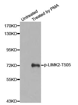 Polyclonal Rabbit anti-Human LIMK2 Antibody (phospho-Thr505, IHC, IF, WB)