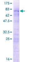 Human LUC7L2 Protein (Recombinant GST)