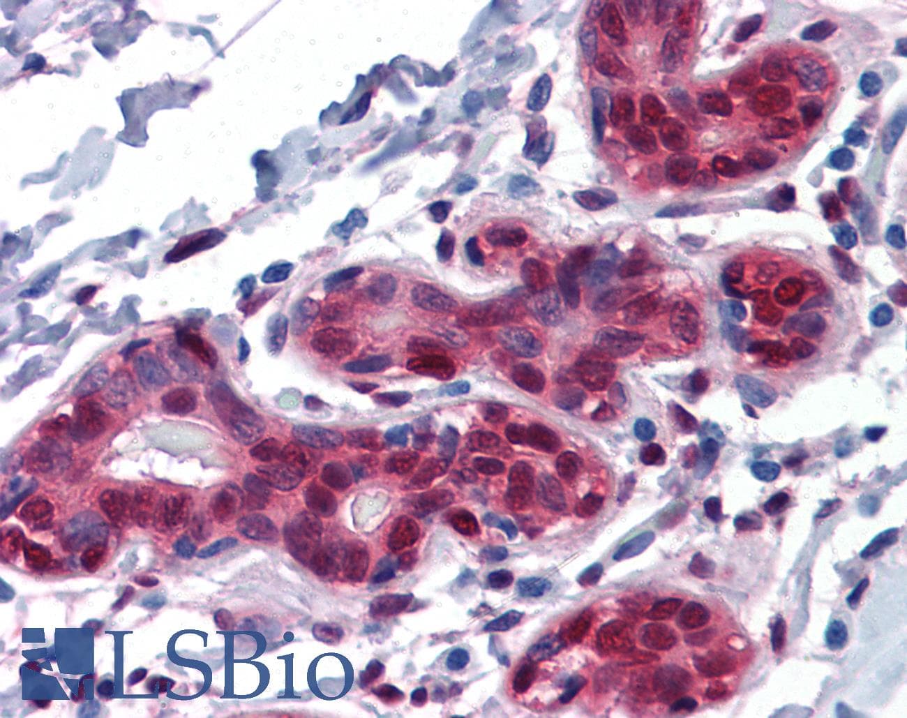 IHC-plus™ Monoclonal Mouse anti-Human YAP / YAP1 Antibody (clone 2F12, IHC, IF, WB)