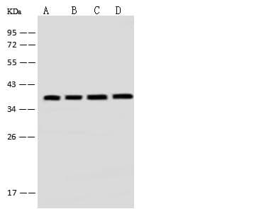AIMP1 / EMAP II Antibody (Preservative Free)