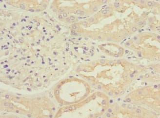 RPGRIP1 Antibody