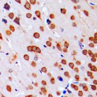 Polyclonal Rabbit anti-Human COPS5 / JAB1 Antibody (Internal, IHC, WB)